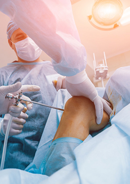 arthroscopy