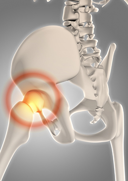 hip arthroscopy
