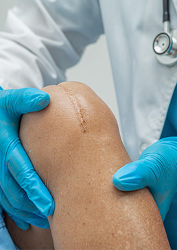 joint replacement