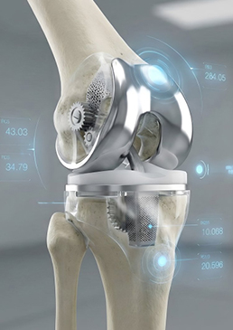 knee replacement